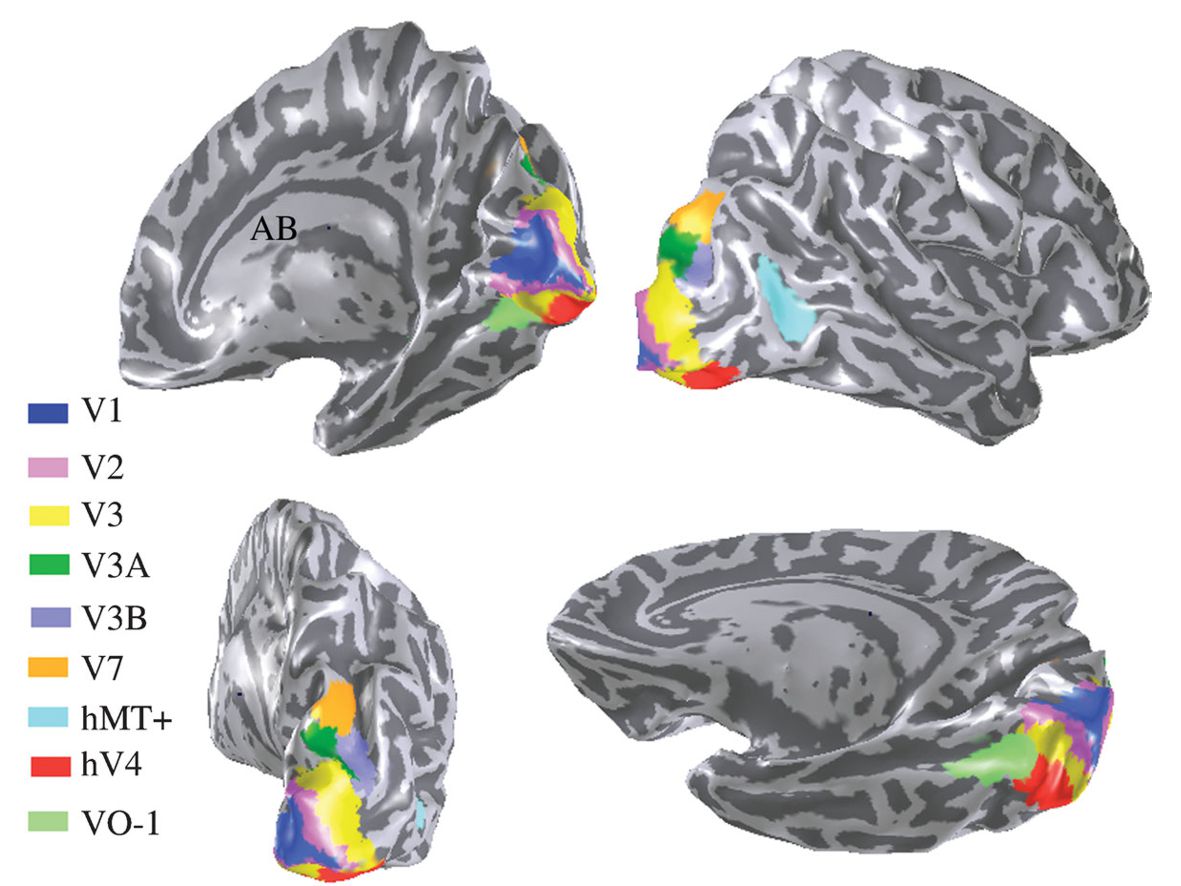 Four views of a brain with visual areas highlighted in different colours.